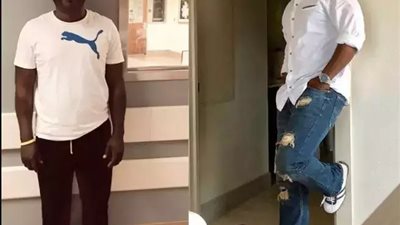 بسبب رفض الفتيات الارتباط به.. أمريكي ينفق 170 ألف دولار ويخضع لجراحة إطالة الساق