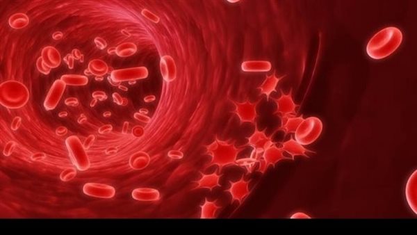 اضطراب الهيموفيليا