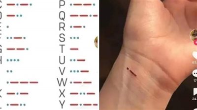 تريند الحروف.. تحدٍّ جديد للمراهقين لقياس طول تقطيع الشرايين