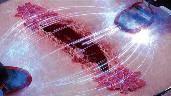 رقاقة بيولوجية