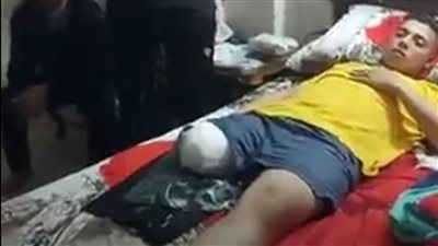 سيارة طائشة تدهس طالب حقوق ببورسعيد.. وشاهد عيان: السائق يقود برعونة عكس الاتجاه | فيديو