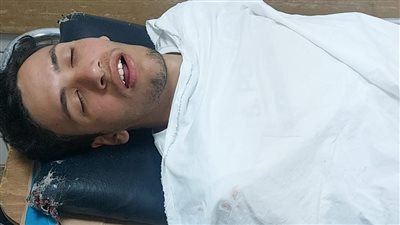 بين الحياة والموت.. إصابة شاب دافع عن شقيقته من التحرش ببورتو السخنة