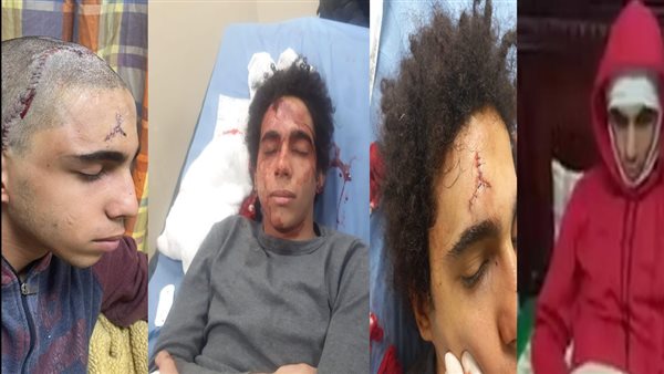 لاعب الكرة المصاب