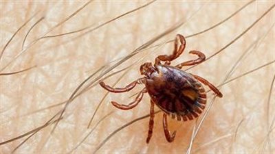 بعد ظهورها في السنغال.. تعرف على أعراض الإصابة بحمى الكونغو