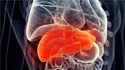 اكتشاف دواء جديد يعالج مرض الكبد الدهني