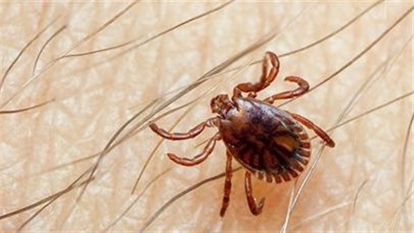 حمى الكونغو 