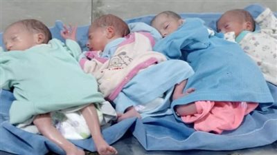 بنتين وولدين.. سيدة تضع 4 توائم خلال عملية قيصرية ببني سويف