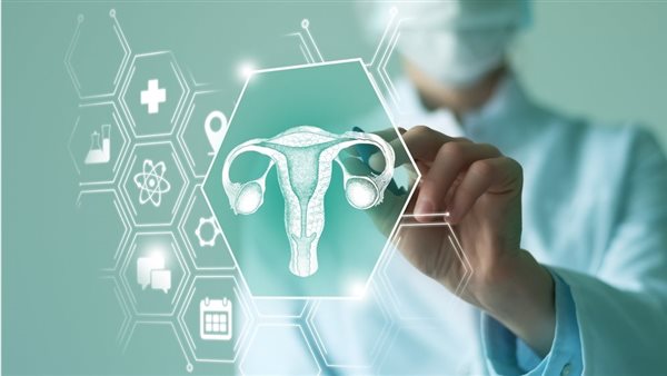 علاج تكيس المبايض