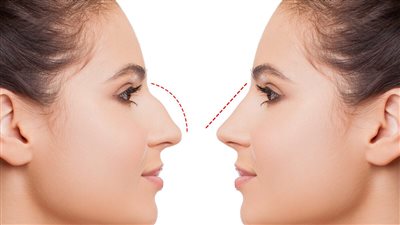 الحمض النووي للإنسان يساعد في تحديد شكل الأنف | دراسة 