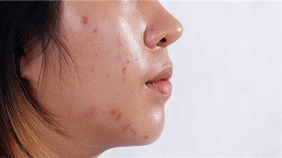 أضرار النوم بالمكياج.. خطر صامت يهدد صحة البشرة