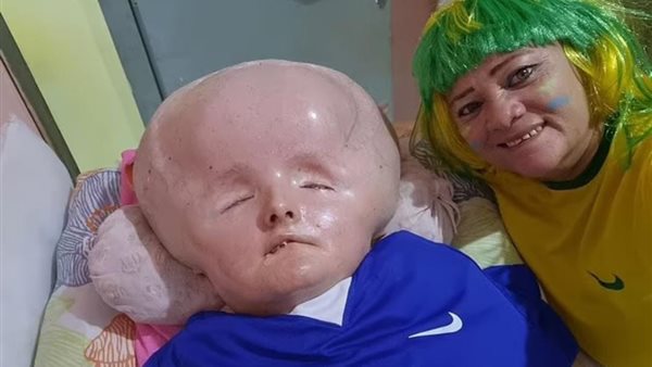 الشابة المصابة