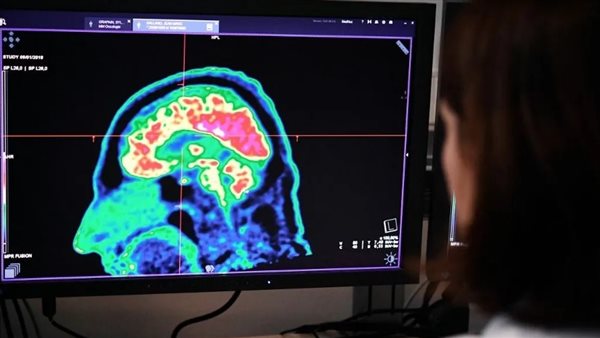 سرطان الدماغ