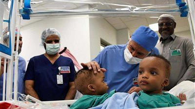 نجاح عملية فصل توأم سيامي نيجيري بالسعودية