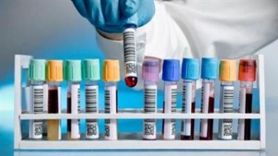 4 اختبارات صحية يجب إجراؤها بعد بلوغ سن الـ 50