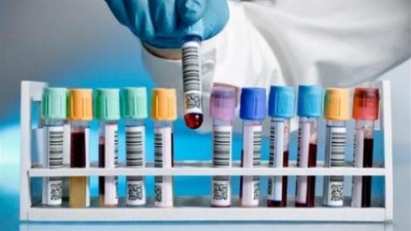 فحوصات طبية