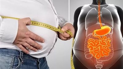 تعرف على عوامل تراكم الدهون الحشوية ومخاطرها على صحة الجسم