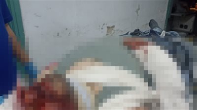 خطفوا شنطته وسحلوه.. إصابة شاب أثناء سرقته من أشخاص يستقلون توكتوك بالقاهرة | فيديو 