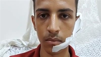 76 غرزة.. طالب أصيب بإصابات خطيرة خلال فض مشاجرة بشبرا: خايف الناس تفتكرني سوابق| بث مباشر 