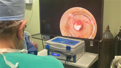 إنقاذ حياة طفل ابتلع جسمًا غريبًا بمستشفى الأطفال ببنها