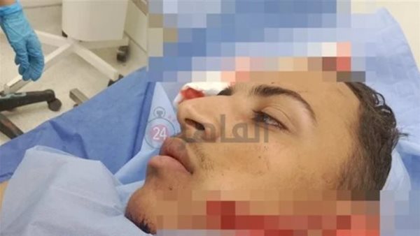 الطالب المصاب بشبرا