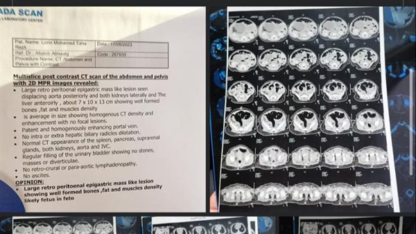 تحاليل نورين 