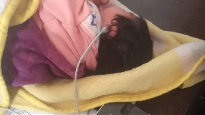 ضمن مبادرة السمعيات.. فحص 11 ألف طفل حديث الولادة بالمنيا خلال مايو الماضي