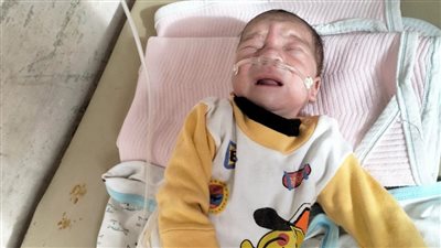 50 يوما معاناة مع ضيق التنفس.. أب يستغيث لإيجاد سرير بالعناية المركزة بمستشفى أطفال مصر لعلاج نجله