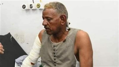 ساقها وهي مولعة.. ننشر أول صورة لسائق سيارة الوقود بعد إصابته في حريق محطة بنزين المعنا