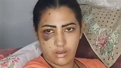 سيدة تشكو خيانة زوجها وتعدي أسرته عليها ببني سويف: خاني بعد 3 أيام من جوازنا| بث مباشر