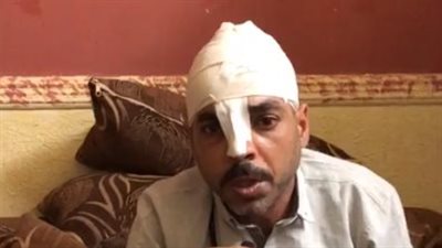 40 غرزة.. 6 أشخاص يعتدون على حارس جراج بالقليوبية: ضربوني عشان بلغت عن سرقة فتيس | بث مباشر