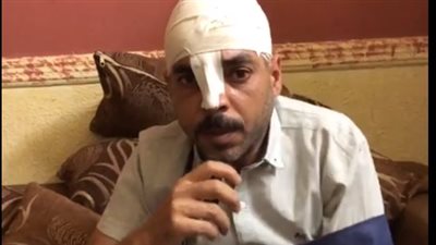 دي حاجة بسيطة عشان اللي أنت عملته.. كواليس تعدي 6 بلطجية على حارس جراج بالقليوبية| فيديو 