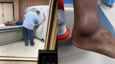 إصابة عمرو وهبة في القدم.. والفنان: الواحد من زمان مقضاش الإجازة في مستشفى حلوة كدة