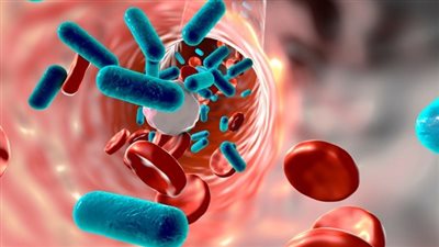 تسببت بوفاة الملاكم محمد علي كلاي.. تعرف على أعراض مرض الصدمة الإنتانية