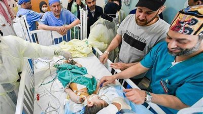 نجاح فصل التوأم السيامي السوري إحسان وبسام بالسعودية 