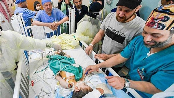 فصل التوأم السيامي