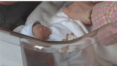 الحالة الأولى في العالم.. سيدة تنجب طفلا مصابا بمتلازمة ألستروم بإيطاليا