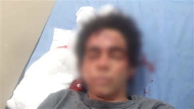 السجن 5 سنوات لمُتهمين هشما رأس لاعب كرة قدم ببورسعيد