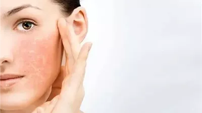 نصائح للعناية بالبشرة الدهنية.. تعرف عليها 