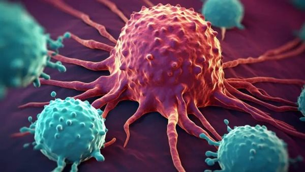 الأورام السرطانية