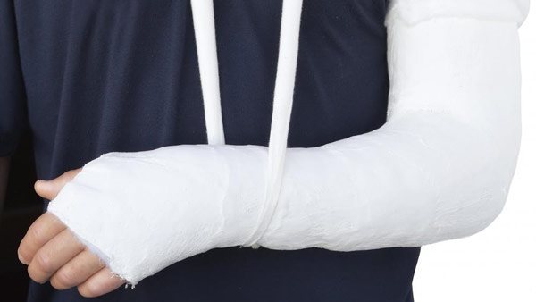 حالات الكسر 