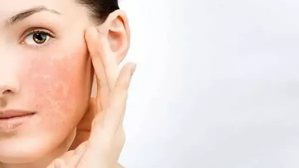  صورة تعبيرية 