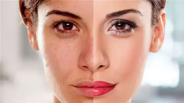 ماسك لتفتيح البشرة