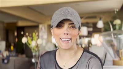 حورية فرغلي: محستش بالحنية من طفولتي.. وناس غريبة خبطوا عليا جابولي ورد وشوكولاته 