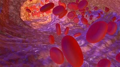 تعرف على متلازمة نقص الجلوكوز 1 وطرق الكشف عن الإصابة