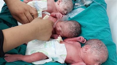 سيدة تضع 3 توائم داخل أحد المستشفيات بالمنوفية