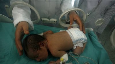 دراسة: الأمهات المصابات بمرض عقلي أكثر عرضة للولادة المبكرة