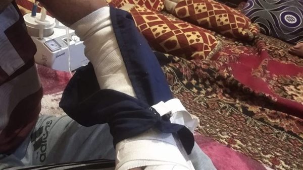 إصابة العامل 