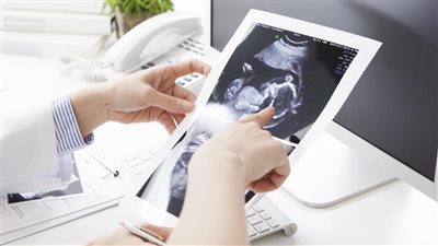 أزهري: لا يجوز للزوجة إتمام التلقيح بعملية الحقن المجهري بعد وفاة زوجها