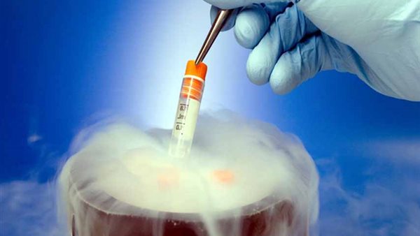 تجميد البويضات