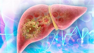 مصابو الالتهاب الكبدي الوبائي لديهم مخاطر أعلى للإصابة بالسرطان أكثر من المدخنين | دراسة